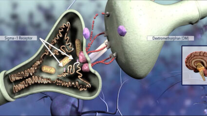 Agitation in Alzheimer’s Disease